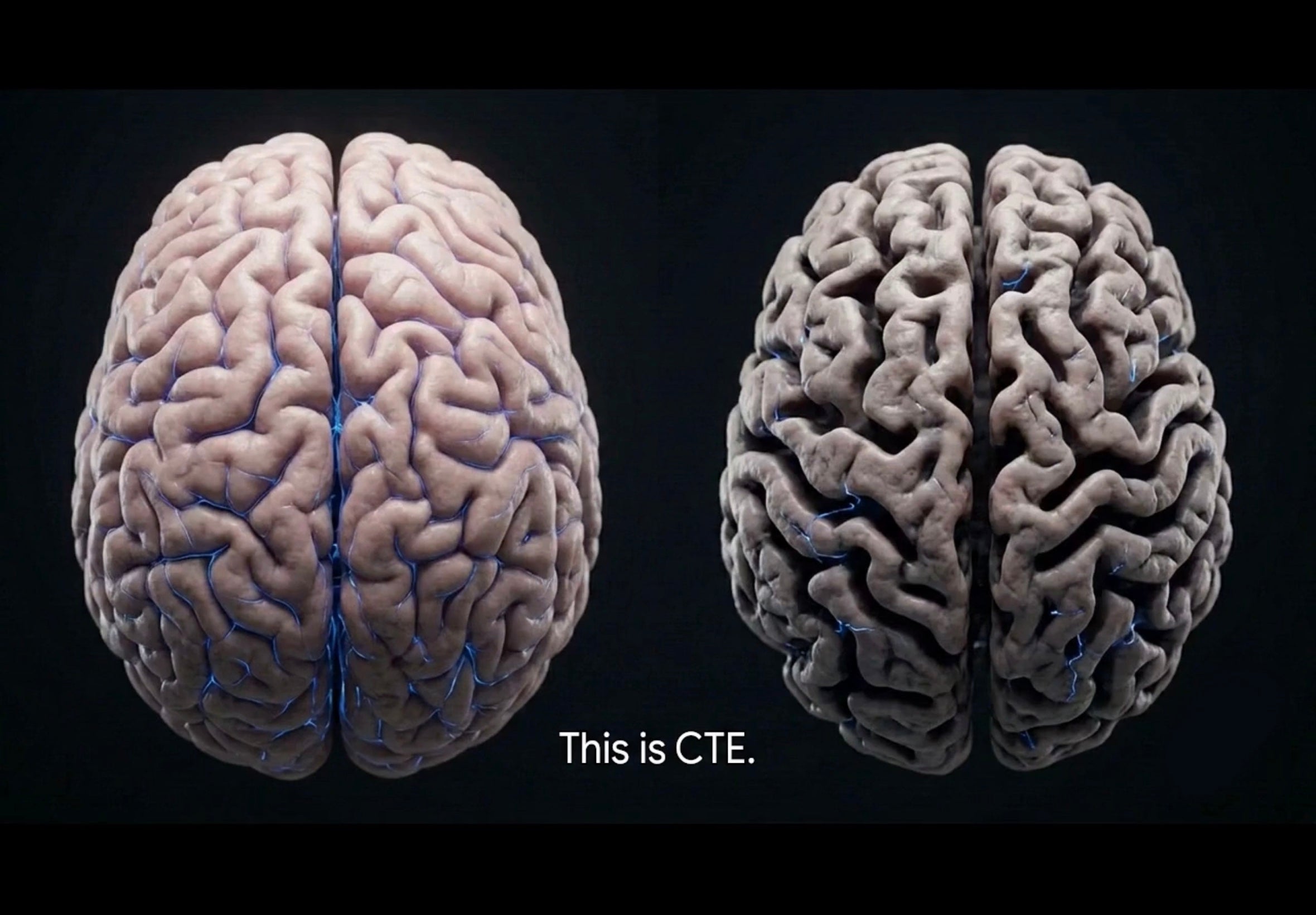 THE SWEET SCIENCE AND THE BRAIN